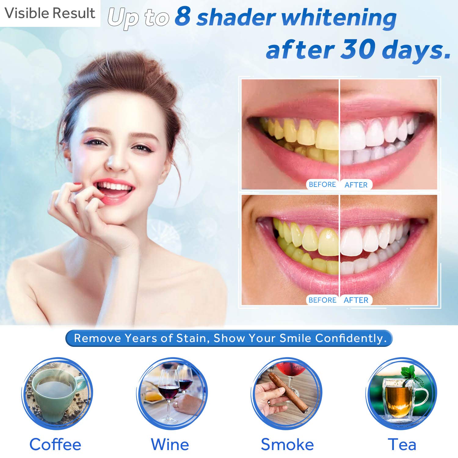 Jeringa de repuesto de Gel par - Teeth Whitening Pens reseña y precio