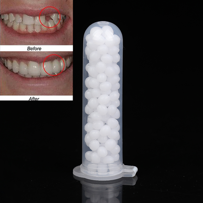 【K】1 caja: kit de reparación t - Teeth Whitening Kit reseña y precio