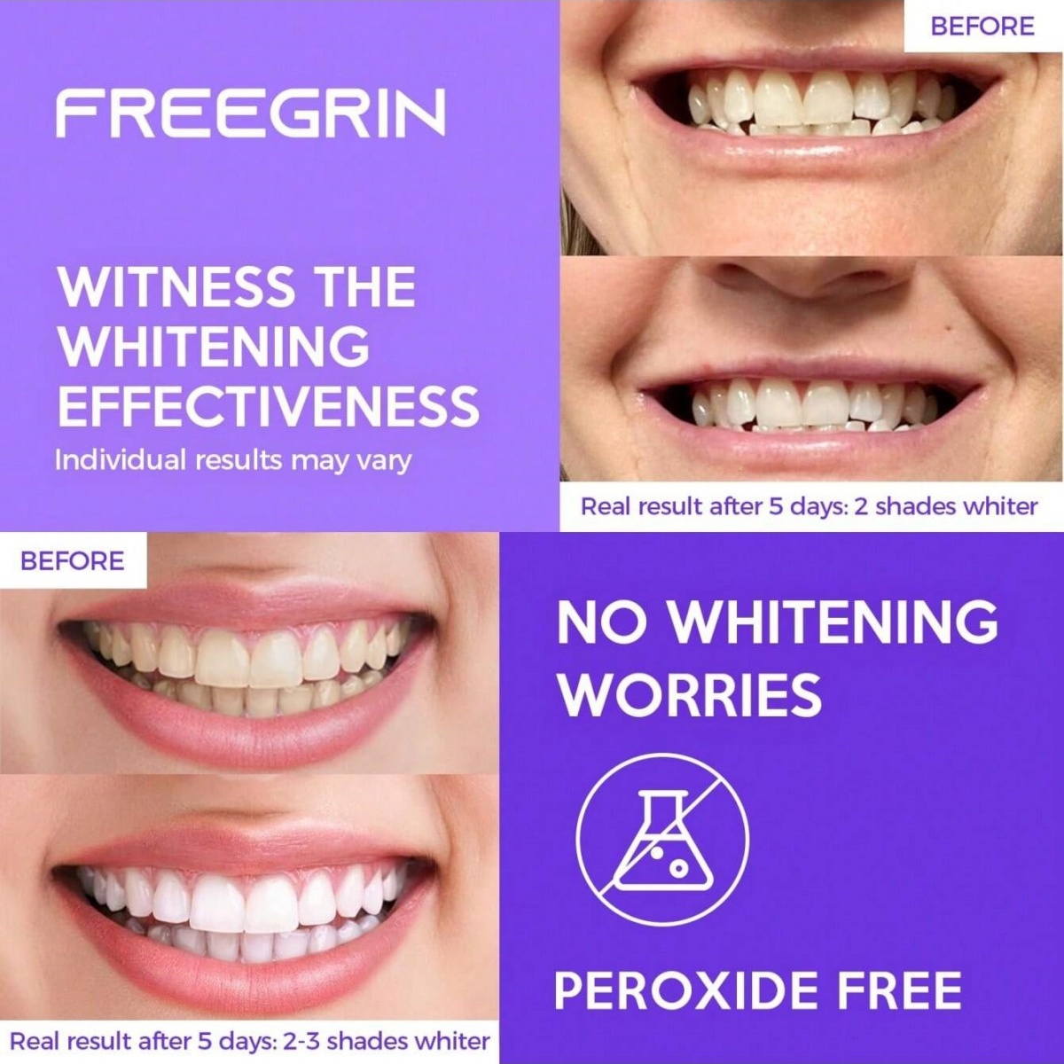 Pegatinas blanqueadoras de die - Teeth Whitening Near Me reseña y precio