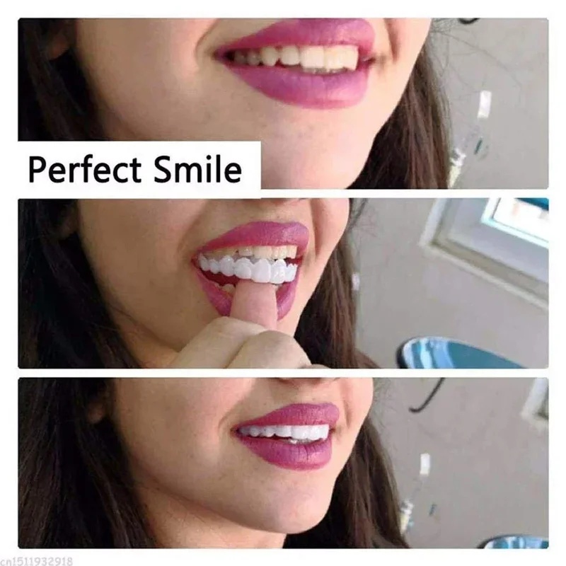 Kit de carillas dentales ajust - Teeth Whitening Kit reseña y precio